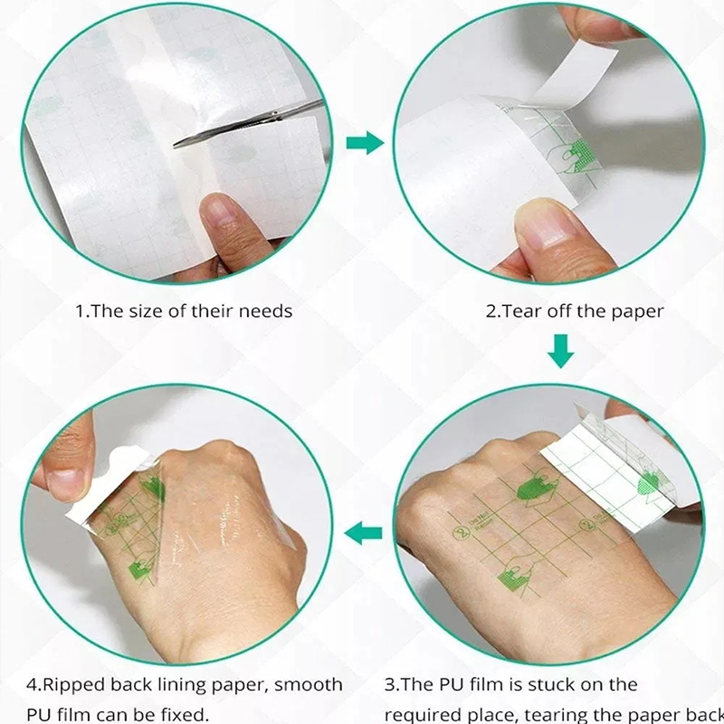 Hypoallergenic Transparent Medical Tape – Gentle Skin Adhesion for Sensitive Patients