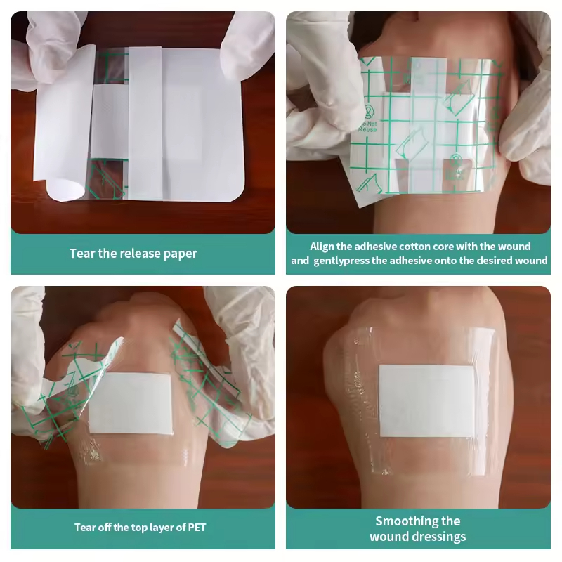 Waterproof Island Dressing with Absorbent Non-Woven Pad