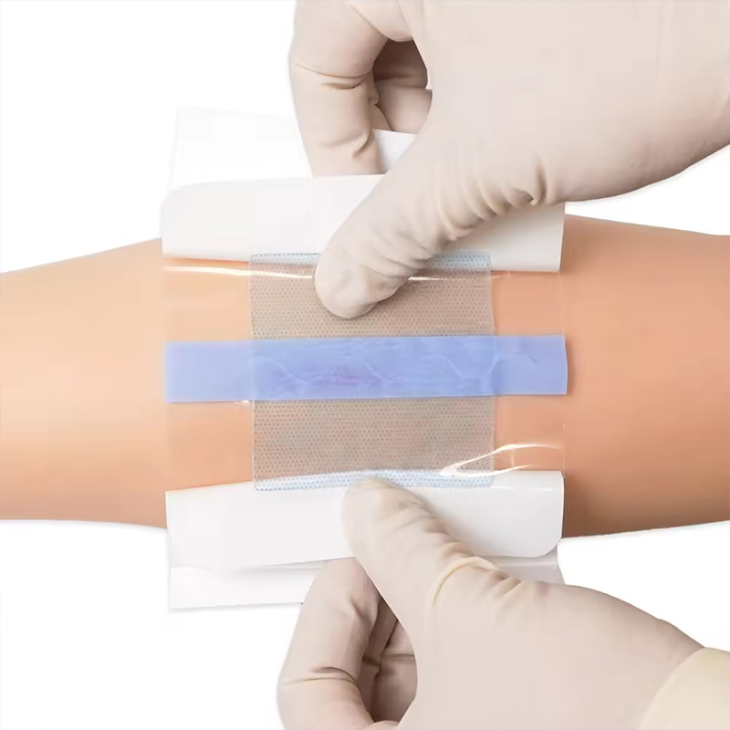 Transparent Hydrogel Dressing for Visual Wound Monitoring
