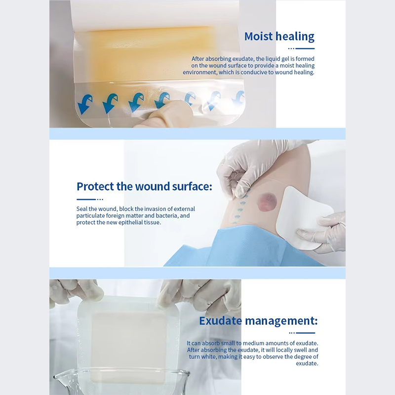Hydrocolloid Healing Patch Pressure Ulcer Paste for Wound Care