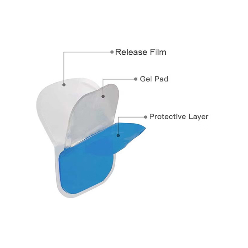 Large Size Hydrogel Burn Patches for Extensive Coverage