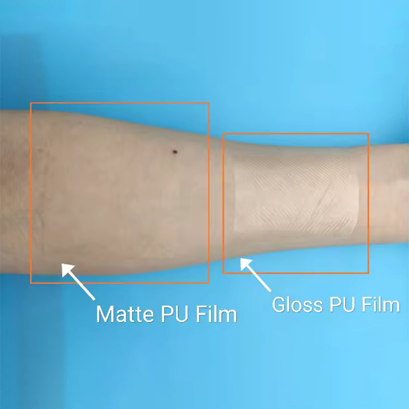 Transparent Film Bandages